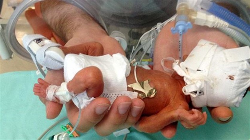 LBCI   طفل معجزة يتحدى الأطباء بولادته في الشهر الخامس