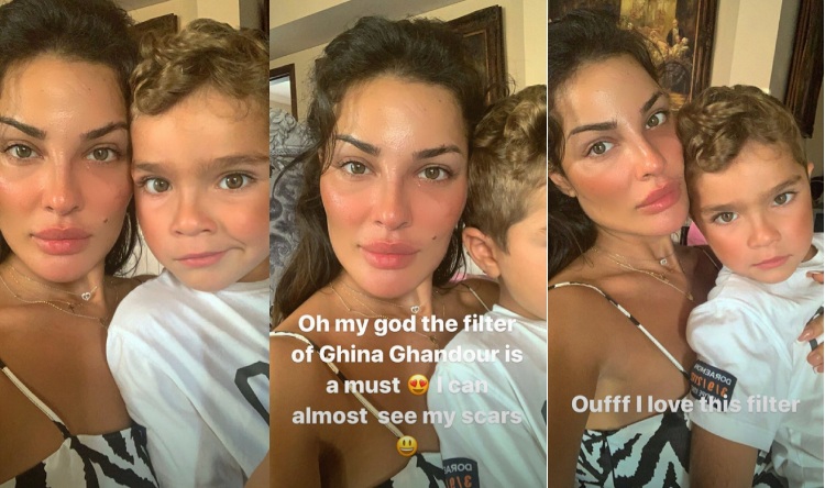 نادين نسيب نجيم تستعين بغنى غندور لإخفاء آثار الجروح على وجهها.. هكذا بدت النتيجة (صور) 