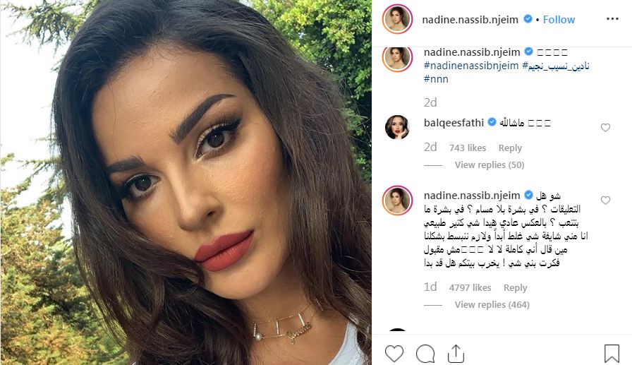 صورة نادين نجيم أظهرت عيوب بشرتها.. وهي تردّ "مين قال إنّي كاملة؟"