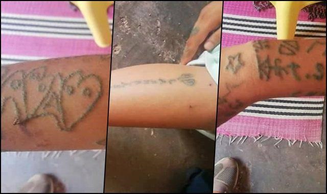 وشوم وعبارات نابية على جسد ضحيةقاصر تعرّضت للاغتصاب