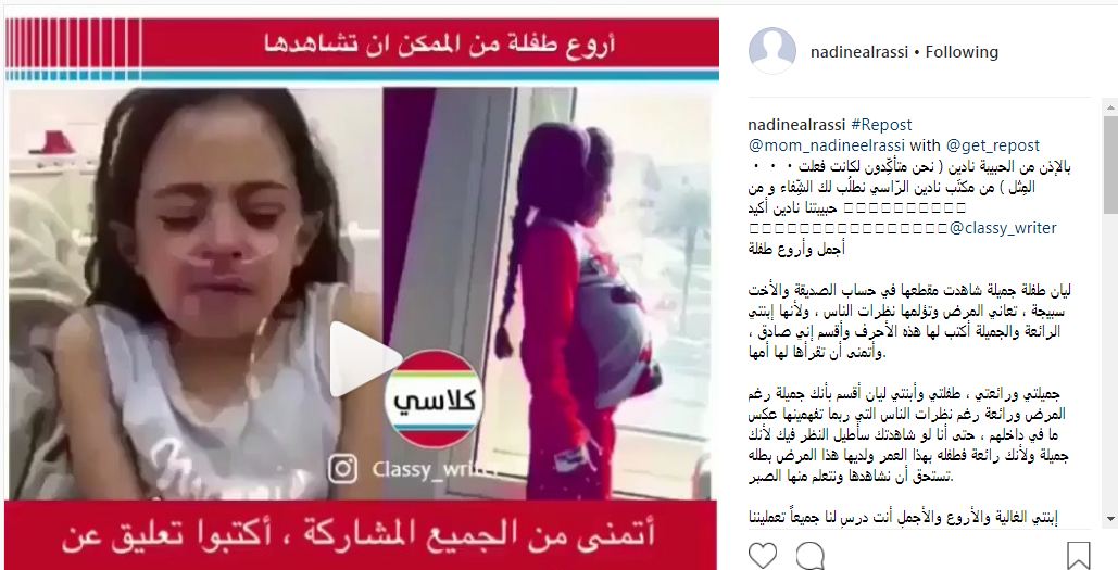 نادين الراسي تكسر صمتها بسبب طفلة تبكي ألماً من نظرات الناس! (فيديو)