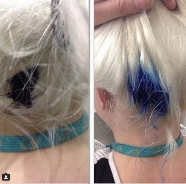 قلم حبر تسبب بظهور بقعة زرقاء في شعر الشابة