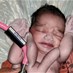 Popular News - "معجزة الطبيعة"... ولادة طفل بأربعة أذرع وأرجل في الهند (صور)
