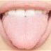 Lastest News - متلازمة الفم الحارق... ما هي أسبابها؟