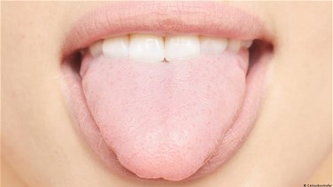 متلازمة الفم الحارق... ما هي أسبابها؟