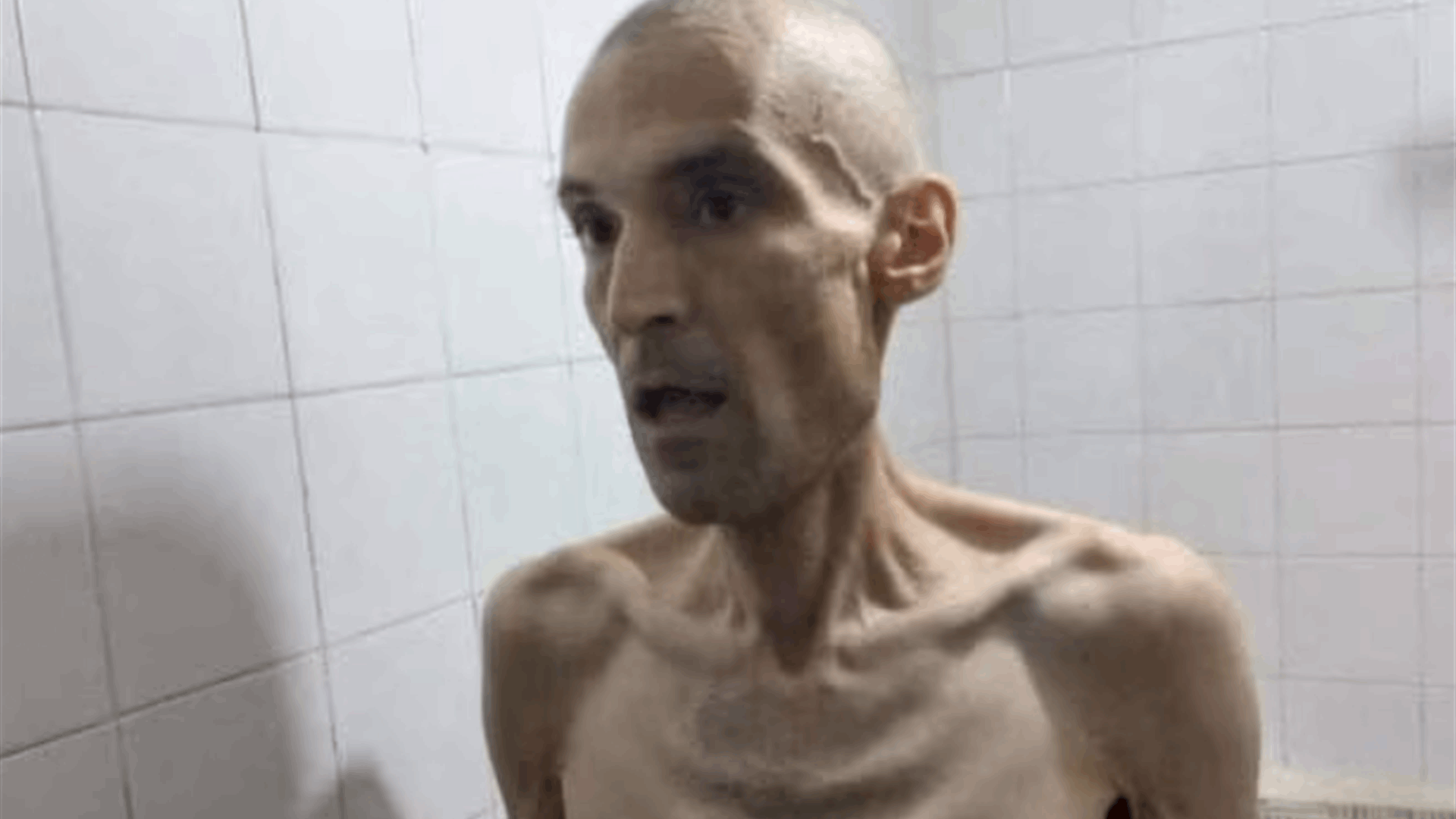 Images of emaciated Iranian prisoner on hunger strike prompt outrage