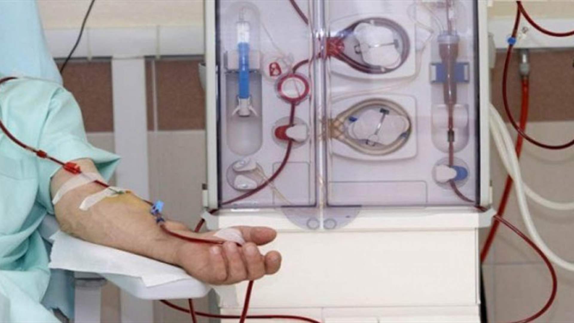 تعاونية موظفي الدولة: تعديل تعرفة جلسة غسل الكلى