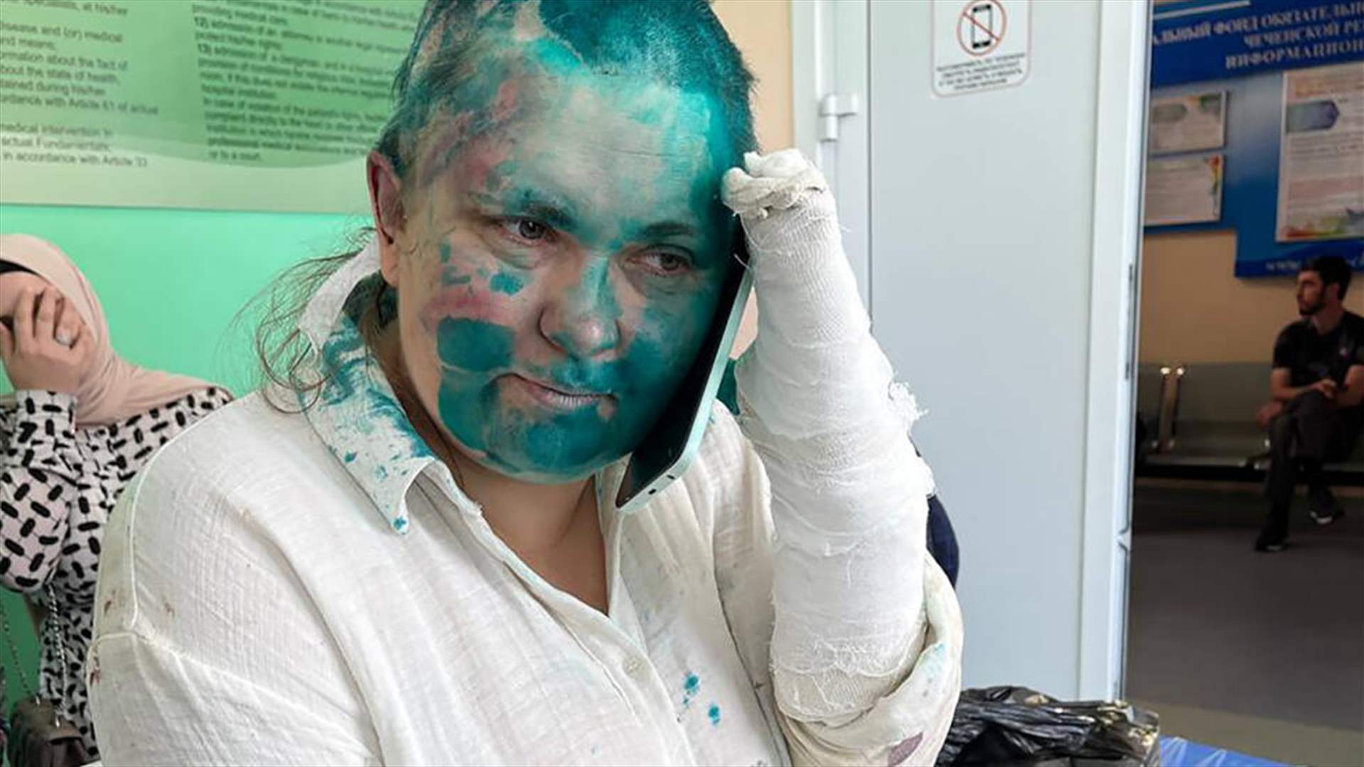 نقل صحافية روسية تعرضت لضرب مبرح في الشيشان إلى مستشفى في موسكو