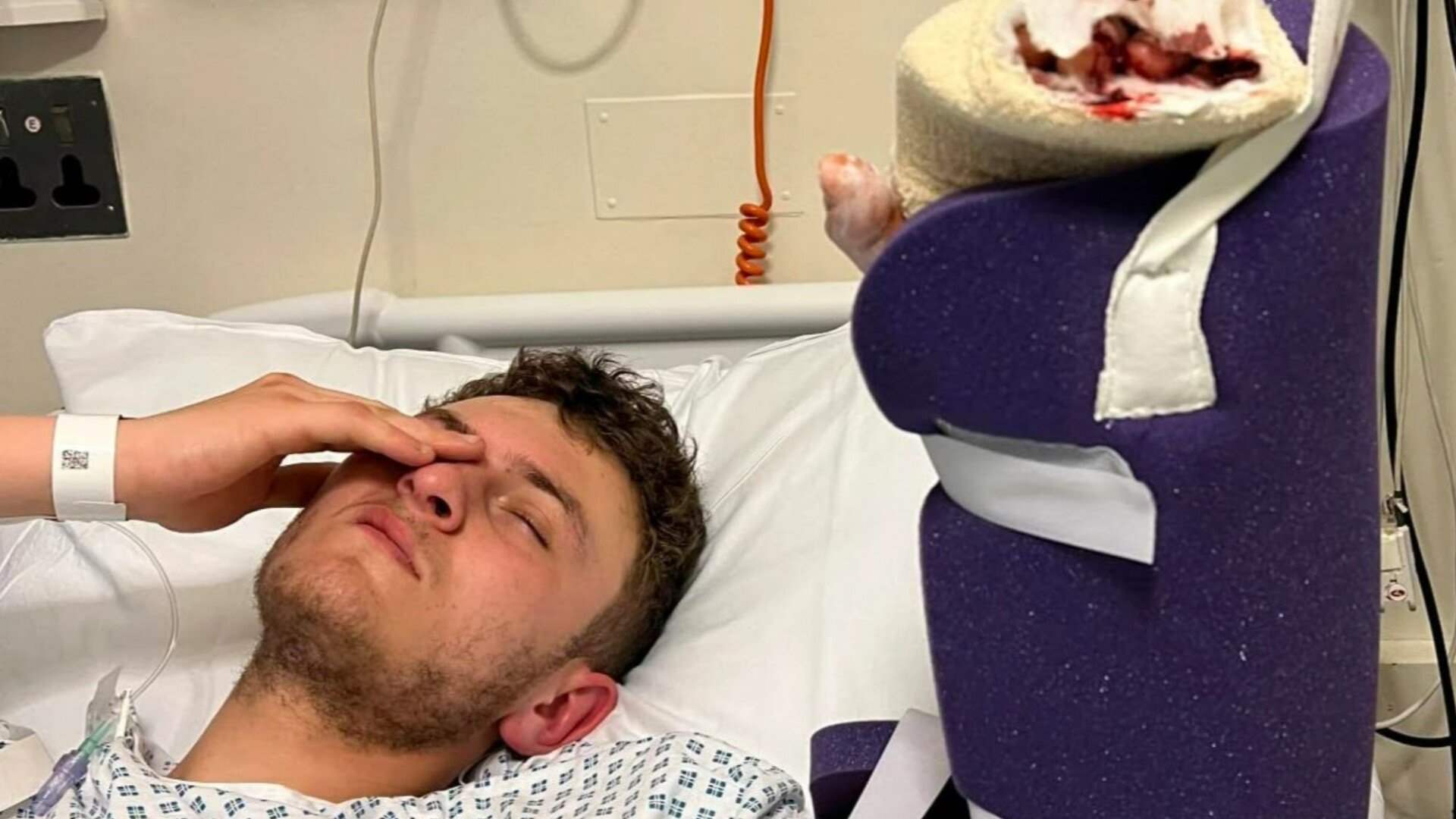 من خدش طفيف في يده الى عدوى بكتيرية كادت أن تقتله... شاب يشارك تجربته المروعة!