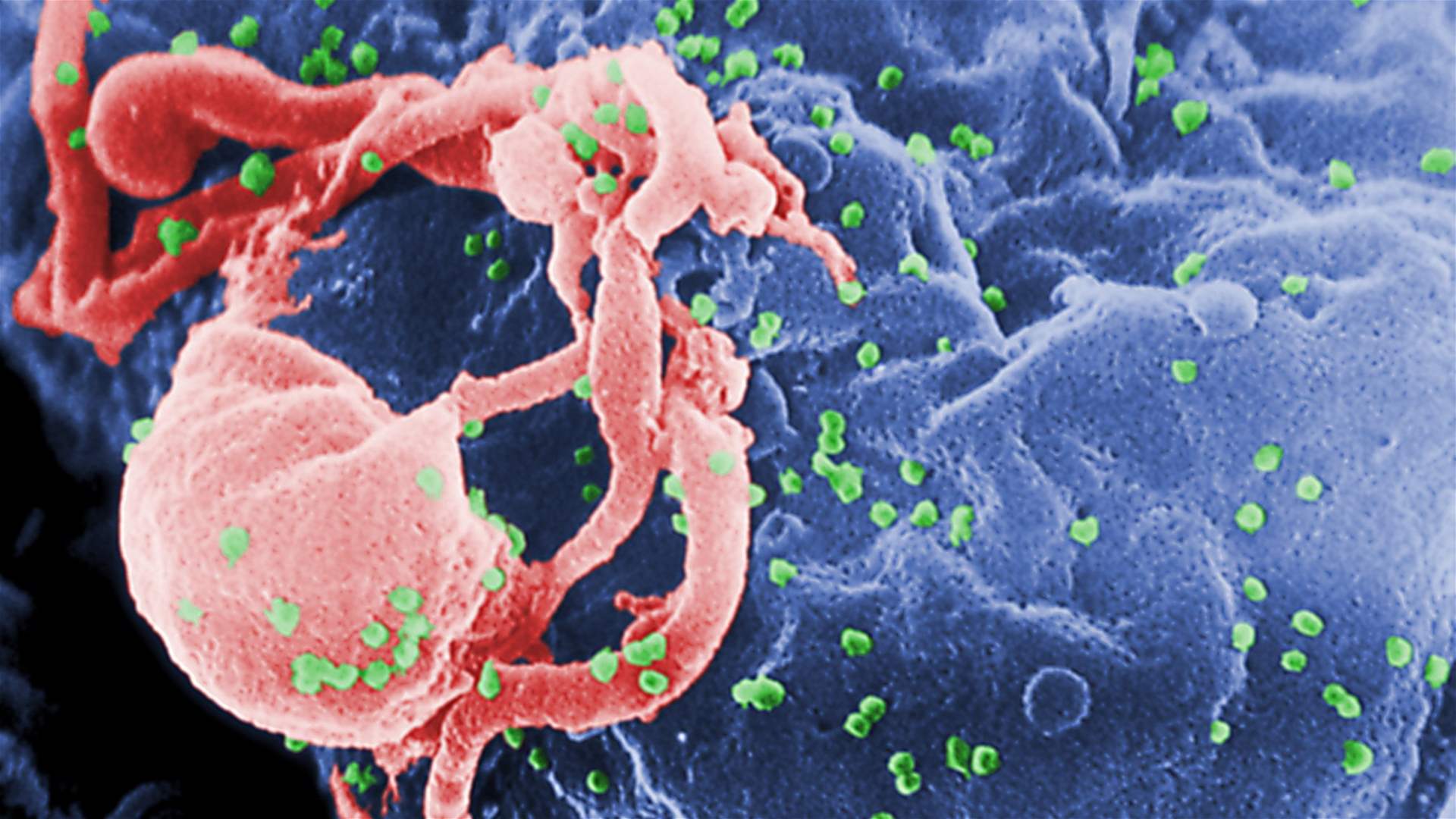 Sydney neighborhood approaches declaration to eliminate AIDS transmission