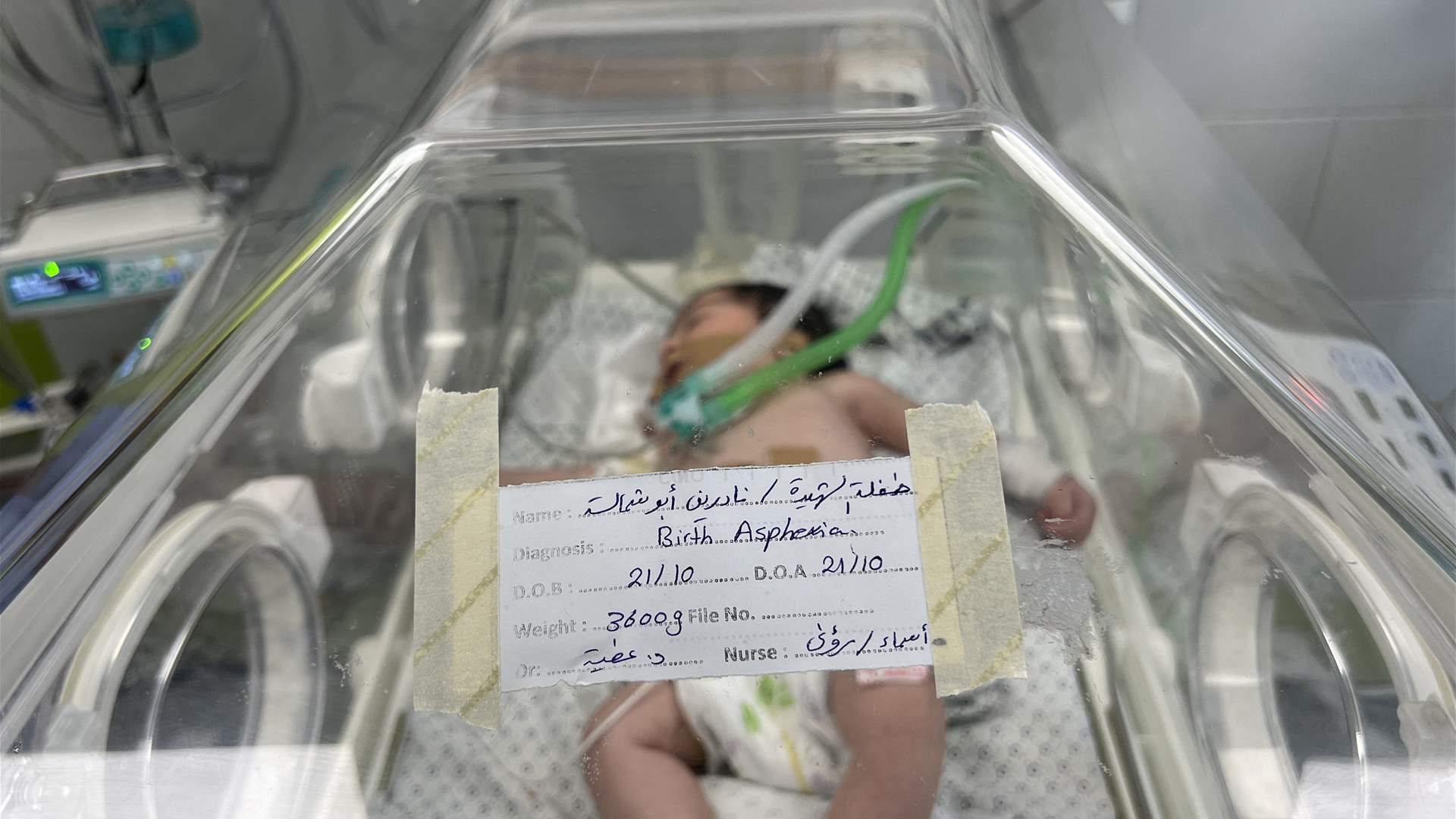 "مكة طفلة الشهيدة"... قصة أمل بالحياة لم تتمكن الحرب من قتله!  (صور)