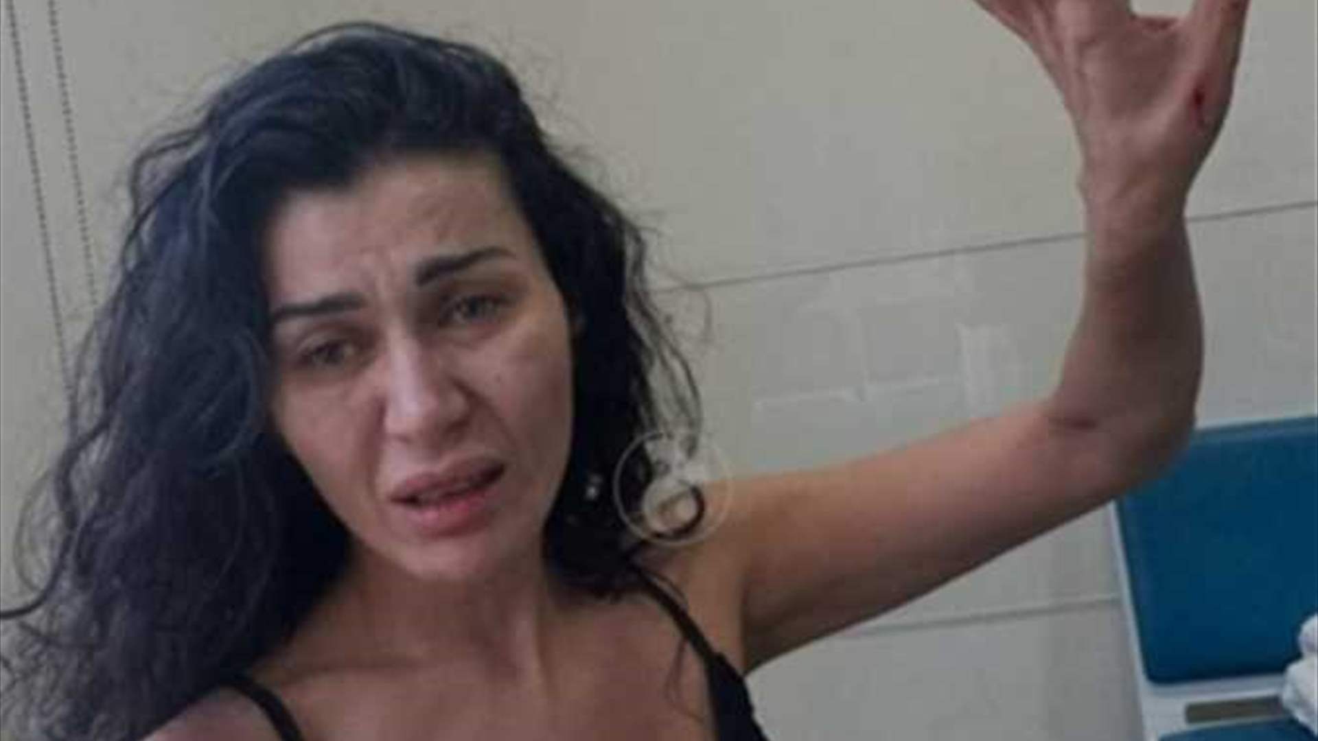 بعد الضرب والصراخ في غرفتها... ما هي حالة والدة نادين الراسي؟ (صورة)