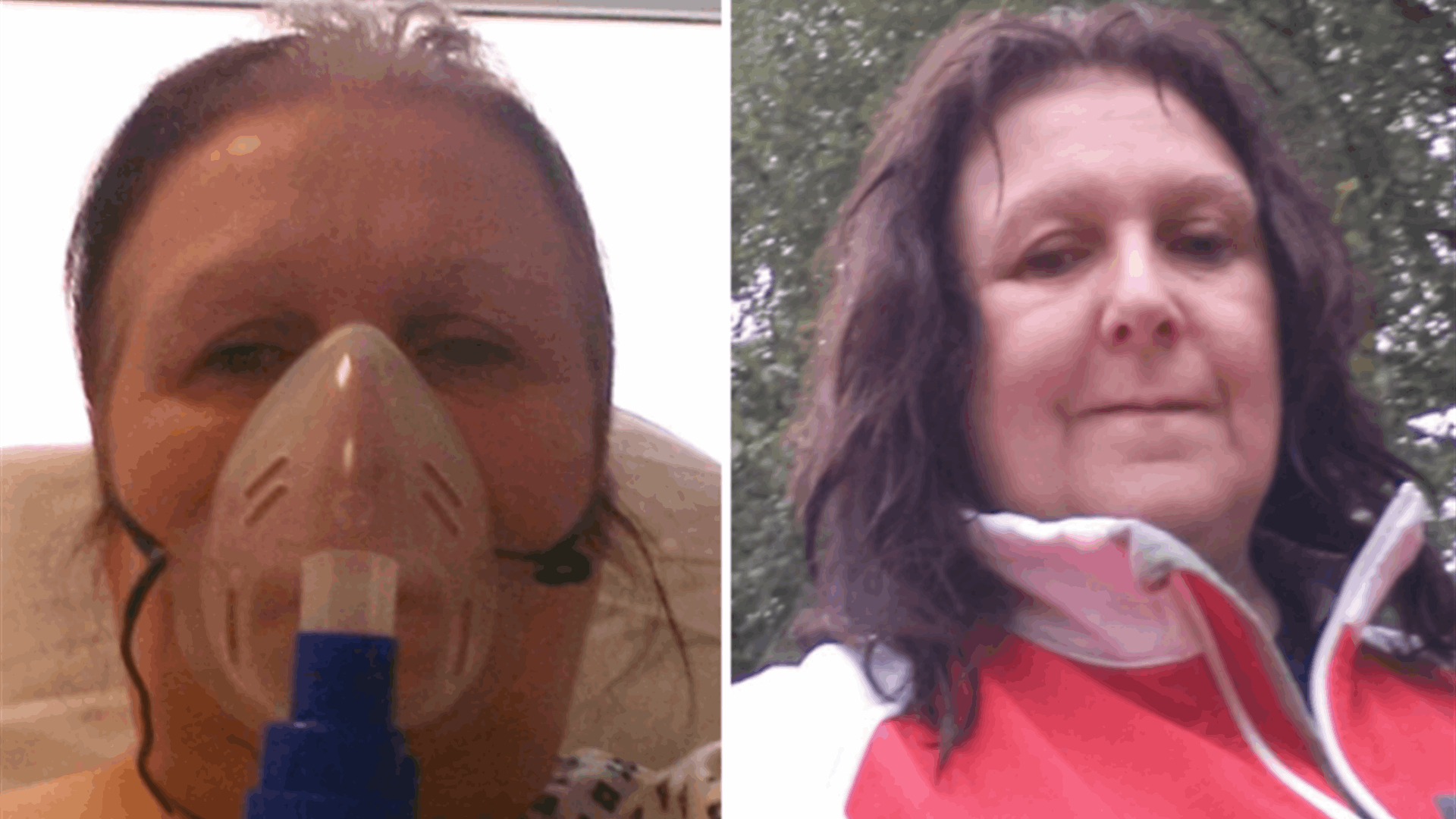 تعاني من حساسية شديدة تجاه رائحة عيد الميلاد... "هذه الأمور يمكن أن تقتلني"!