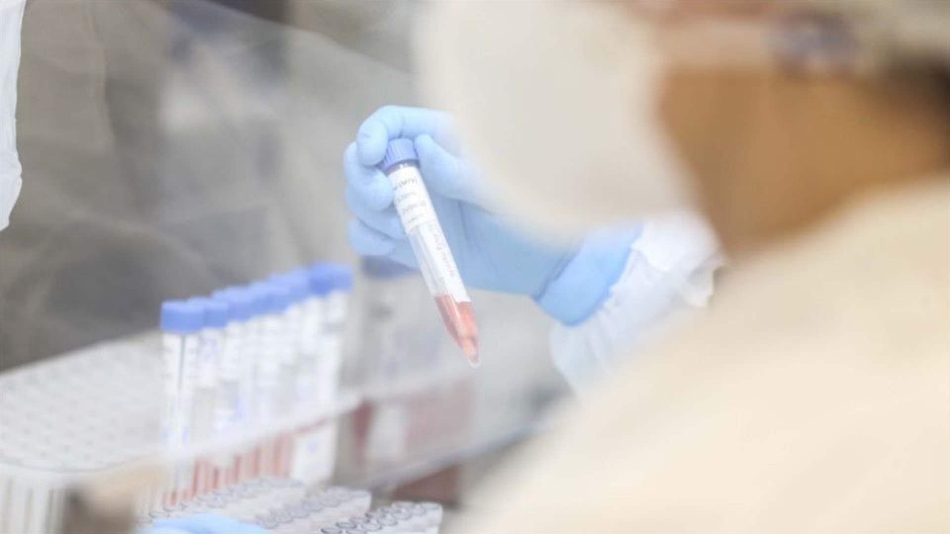 رصد إصابة بشرية أولى في المملكة المتحدة بمتحور لإنفلونزا الخنازير
