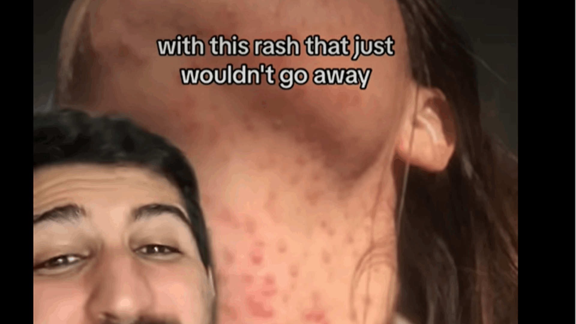 "تحتوي على بكتيريا أكثر من المرحاض"... طبيب يحذر: مادة شائعة بحقائب المكياج النسائية يمكن أن تؤذيهن بشكل مرعب! (فيديو)