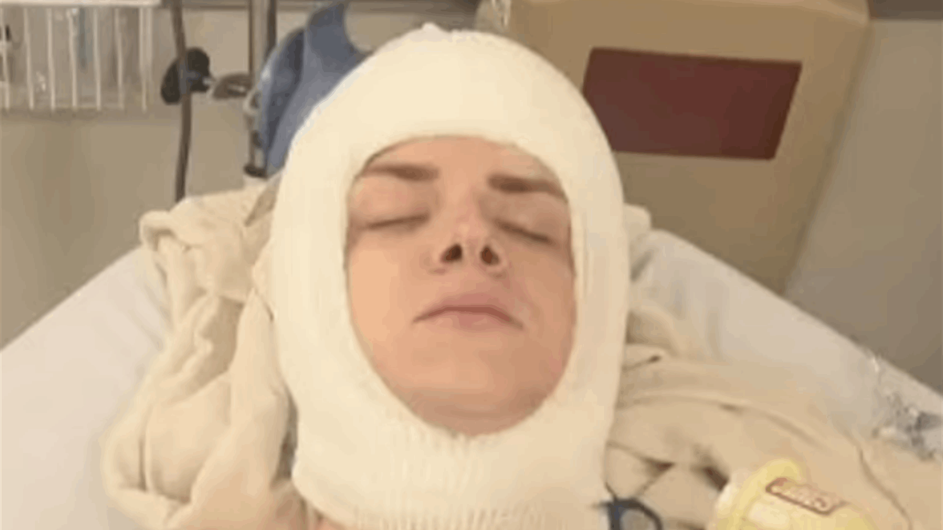 فتحوا جمجمته 4 مرات لغسل دماغه... حادث غامض غيّر حياته: "استبدلوا جمجمتي بشبكة من التيتانيوم"! (فيديو)