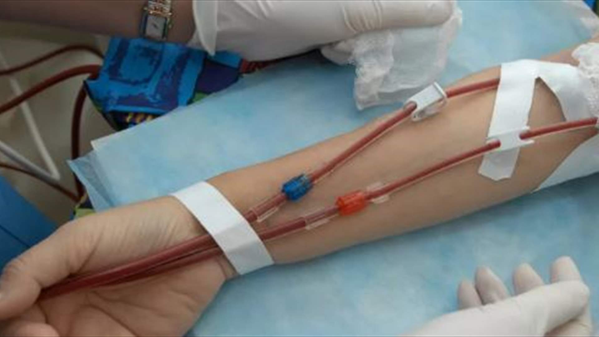 كركي : زيادة تعرفة علاج مرضى غسيل الكلى 60 مرّة كي يبقى مغطًّى 100% من قبل الضمان
