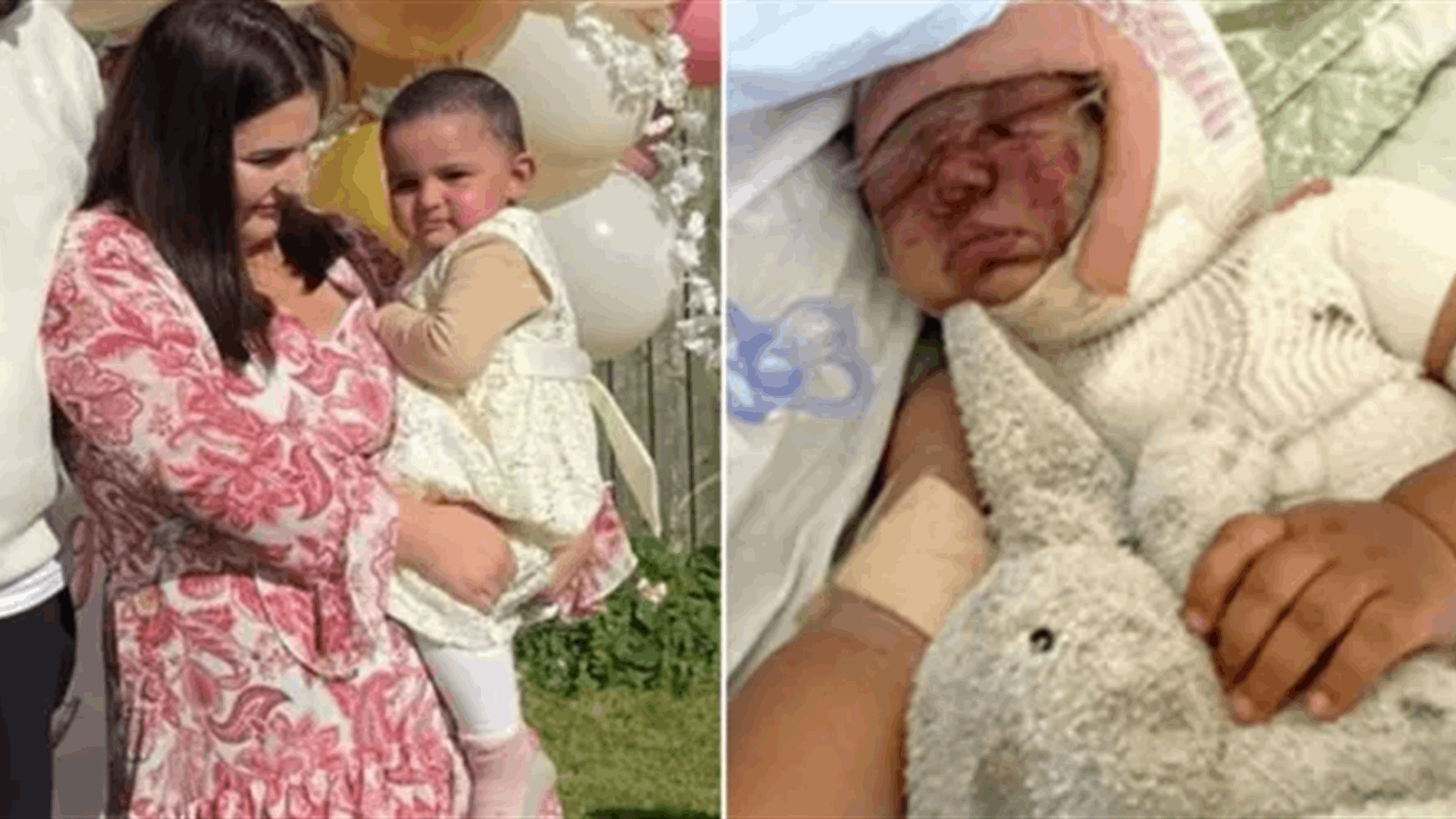 في عيد ميلادها الاول... طفلة تعيش "العمى المؤقت" لهذا السبب: والعائلة تشدد على تحذير الآخرين!
