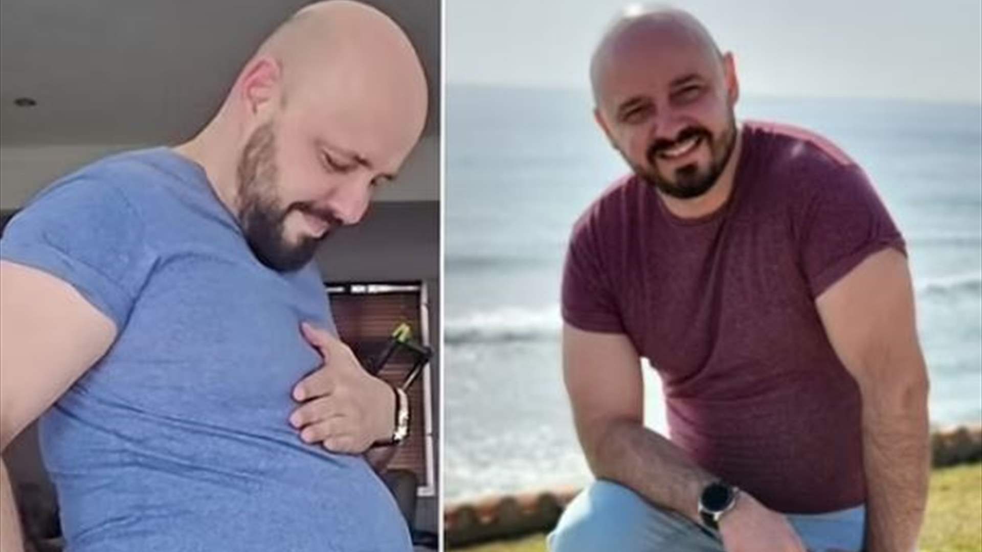 رجل يعاني من حالة مرضية غريبة... يبدو الأخير وكأنه حامل!