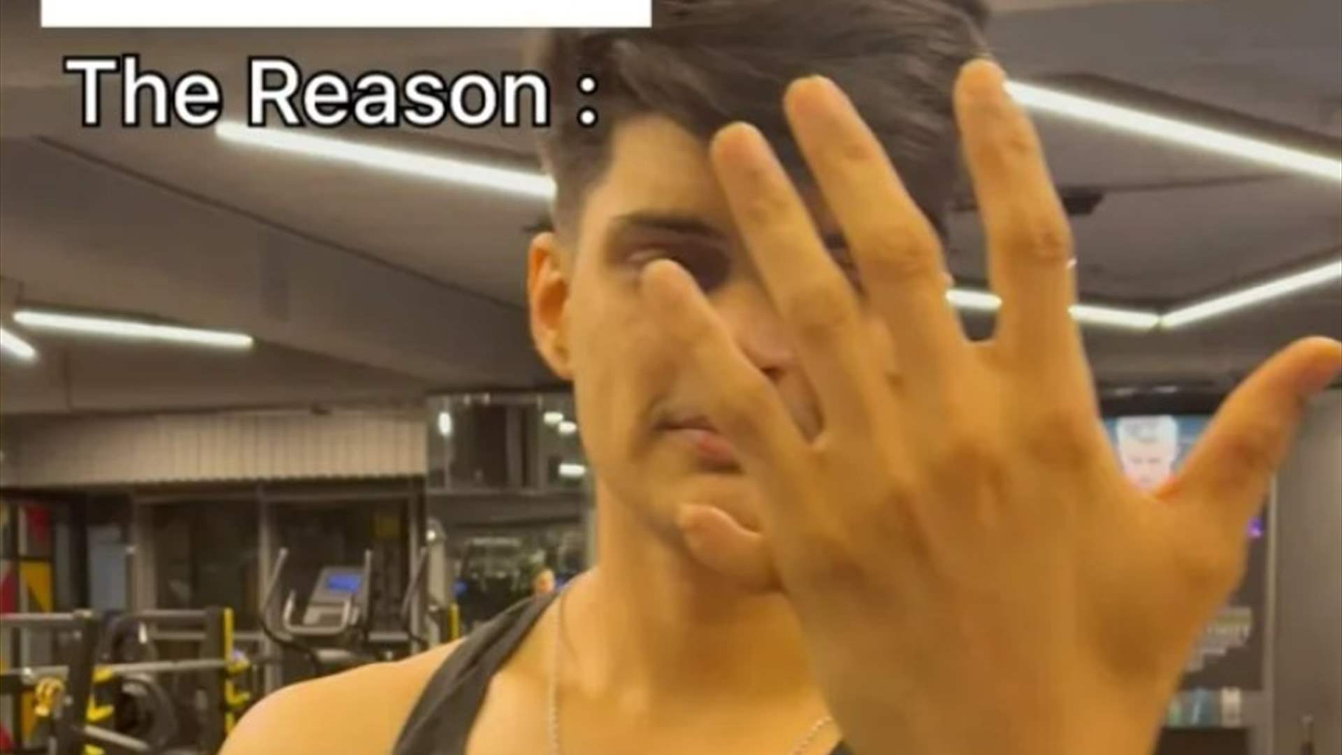 رجل وُلد بـ 12 إصبعاً ويُذهل متابعيه بما يستطيع فعله! (صور)