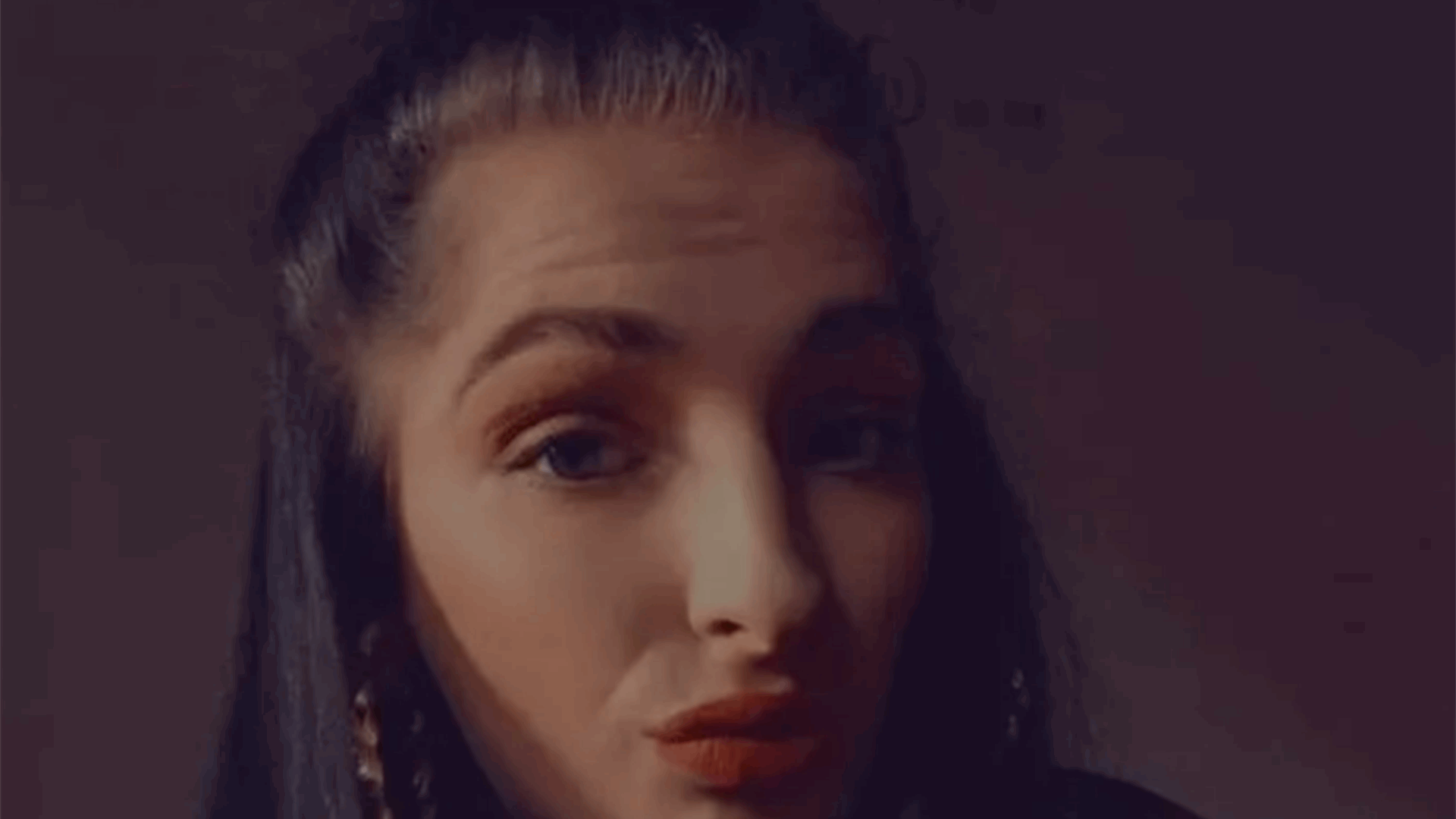بثرة صغيرة أدت الى بتر ساقها... هذا ما حصل مع تشارلي العشرينية! (صور)