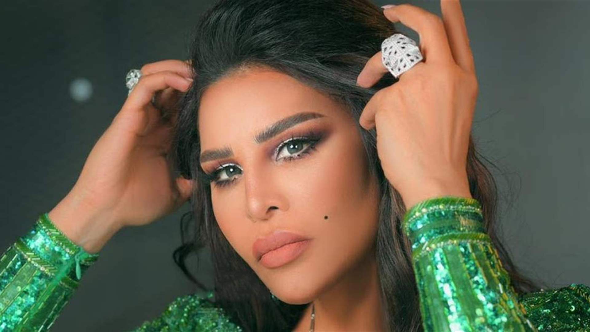 أحلام تتعرض لكسر في يدها اليسرى... وهكذا أطلت في حفلها الأخير (فيديو)