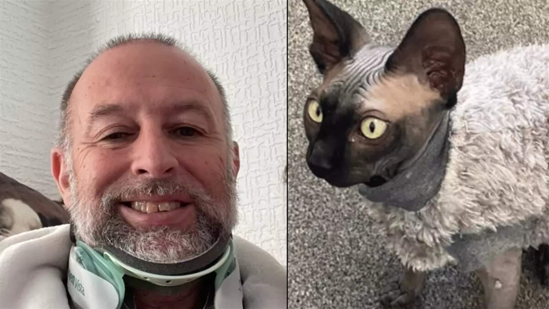 تعثّر بسبب قطته... رجل ينجو من حادث بأعجوبة: "محظوظ أنني ما زلت على قيد الحياة"