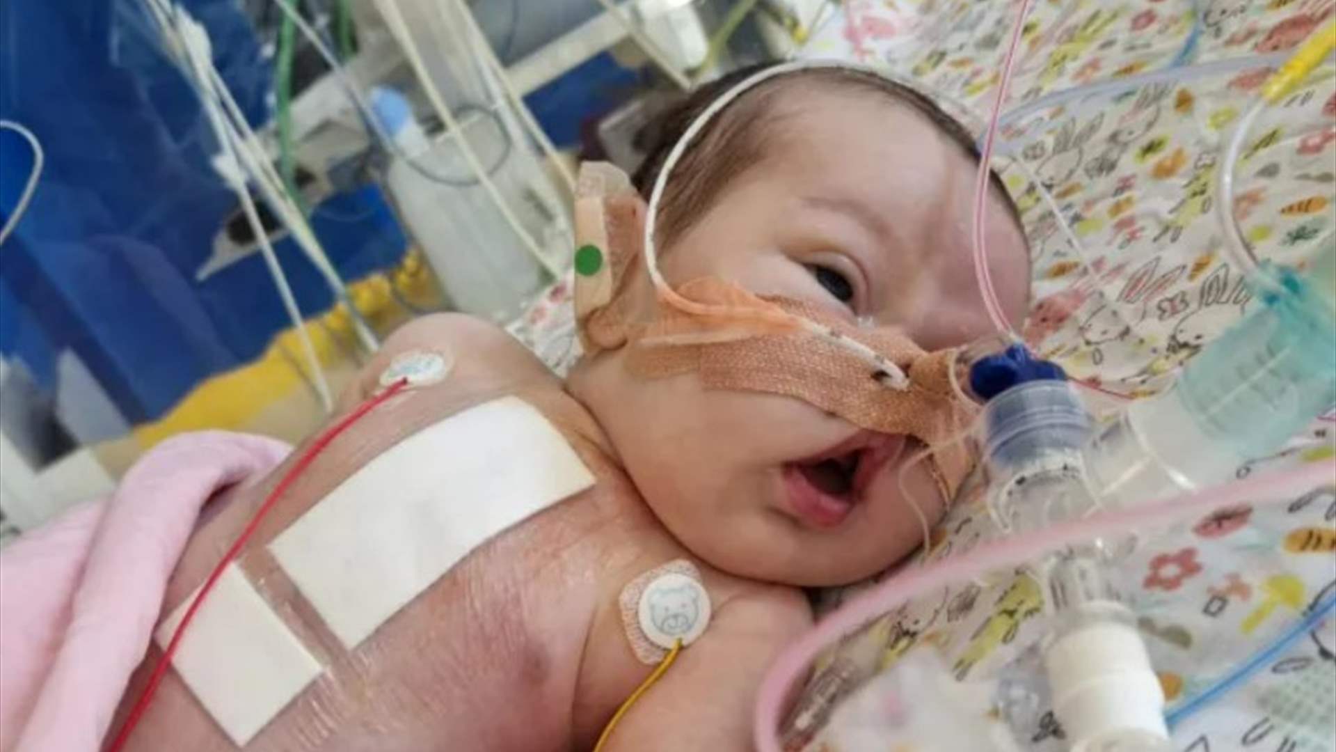 "الفياغرا" ينقذ طفلة من الموت... وُلدت بهذه الحالة النادرة وهذه التفاصيل (صور)