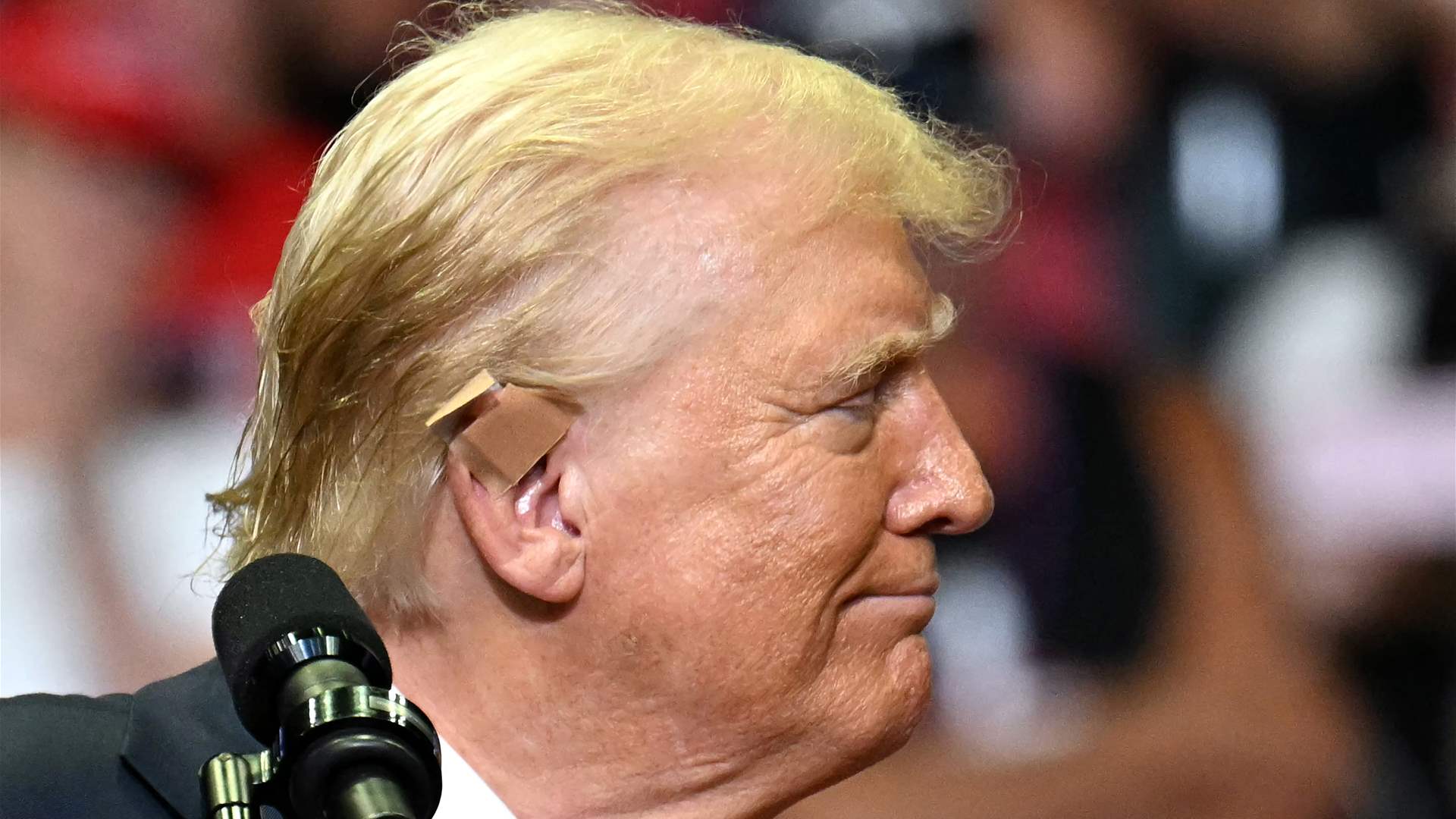 Trump&#39;s former doctor gives new details on gunshot wound