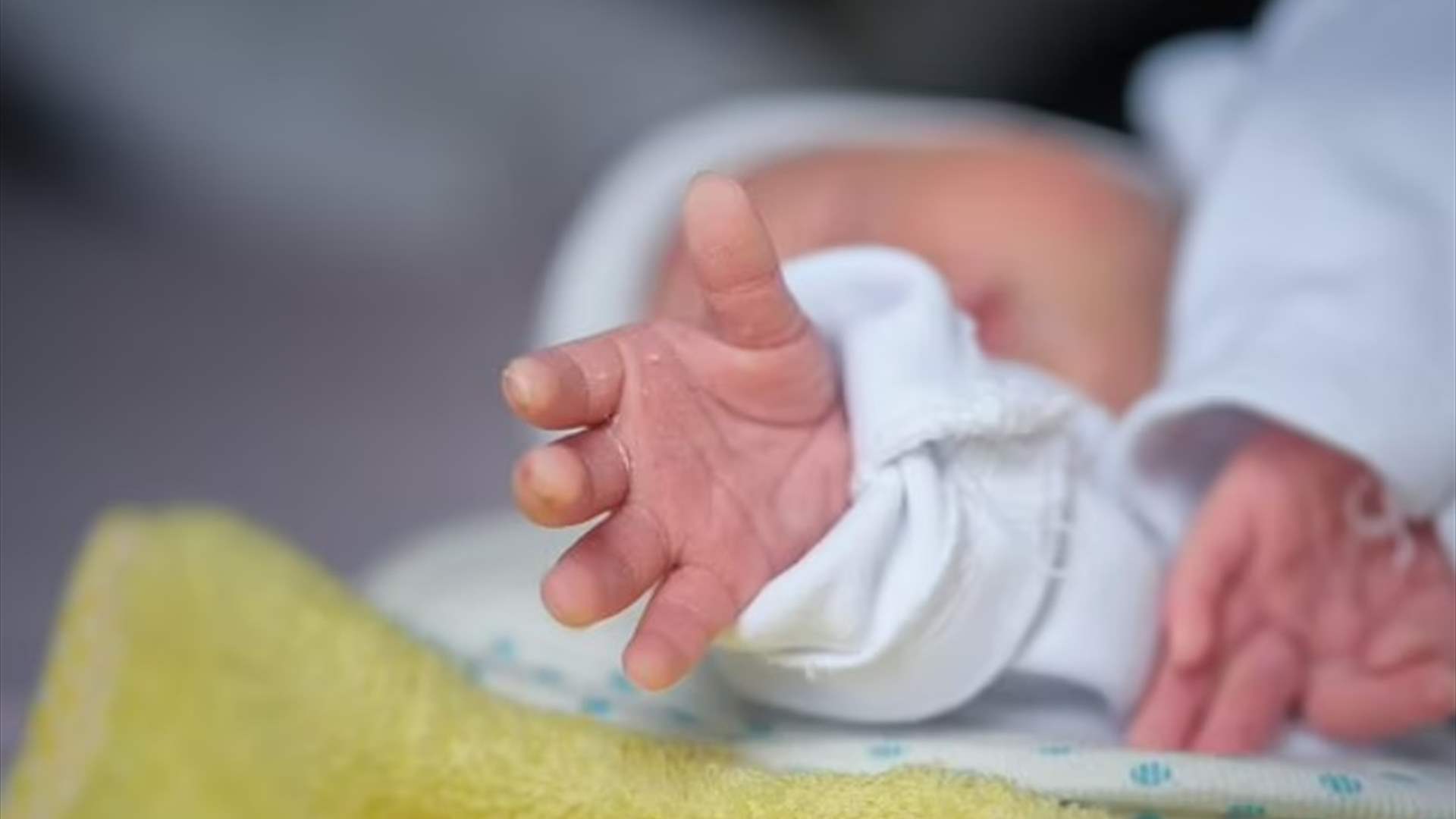 وفاة طفل بعد ولادته مع وجهين و4 أذرع وأرجل... وصور تُظهر الحالة النادرة (صور)