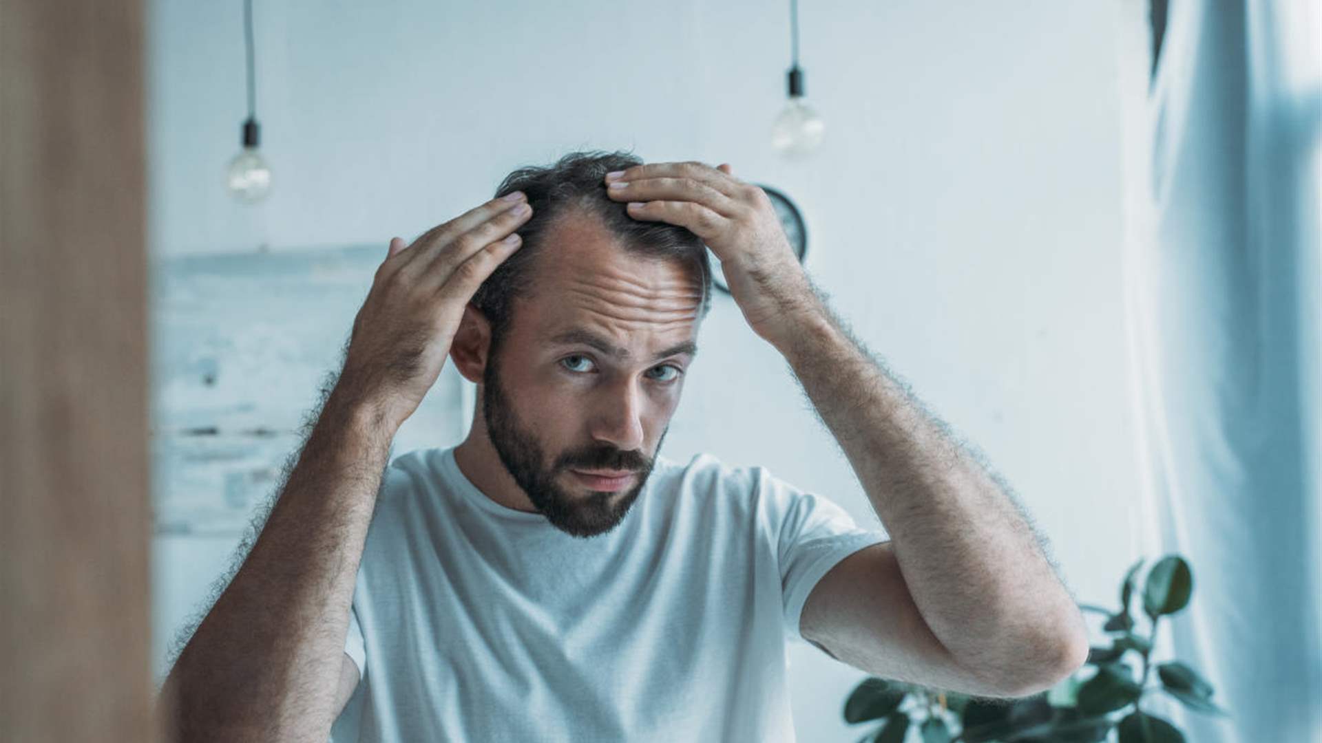 دراسة تكشف... نوع من السكر قد يوقف الصلع الوراثي لدى الرجال!