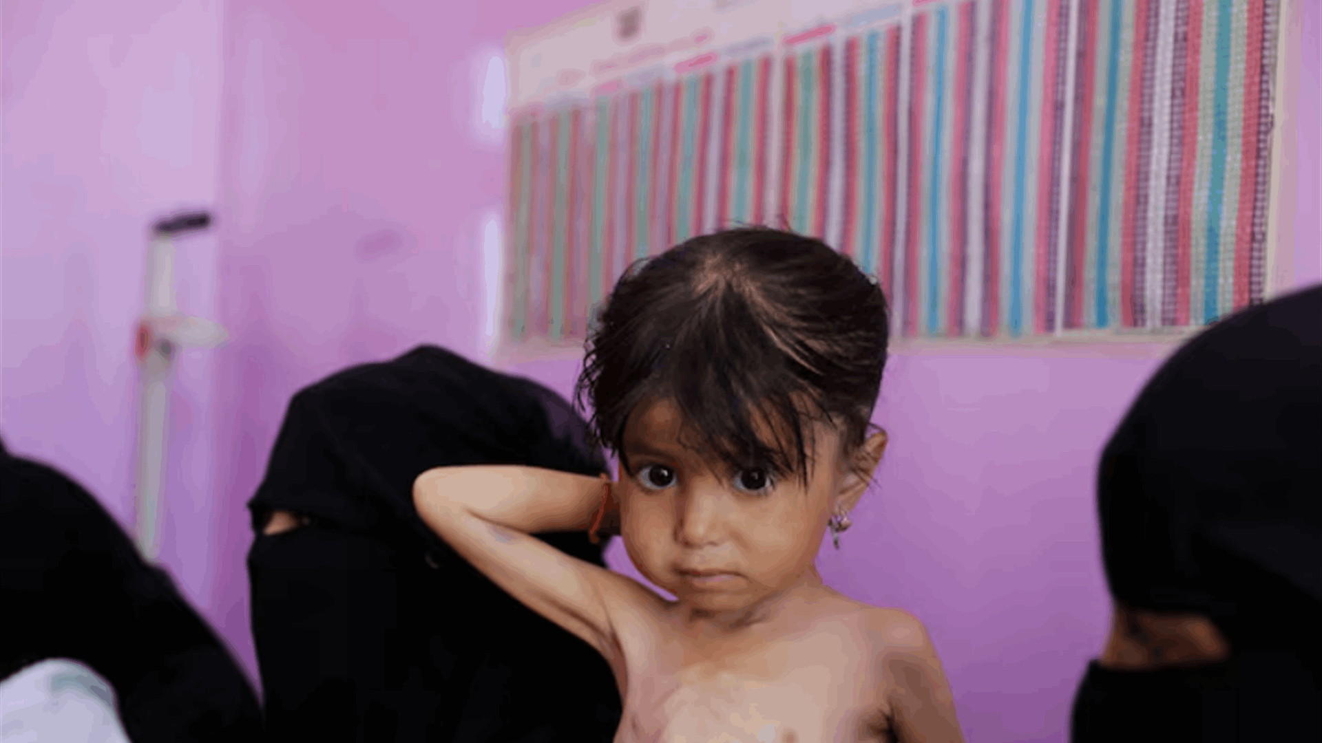 UN: Malnutrition worsening in Yemen&#39;s government-controlled areas