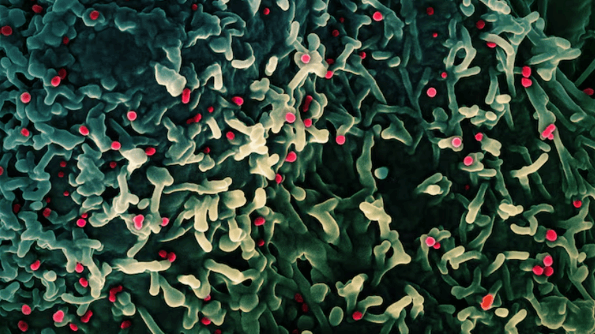 WHO: Mpox is not the new COVID