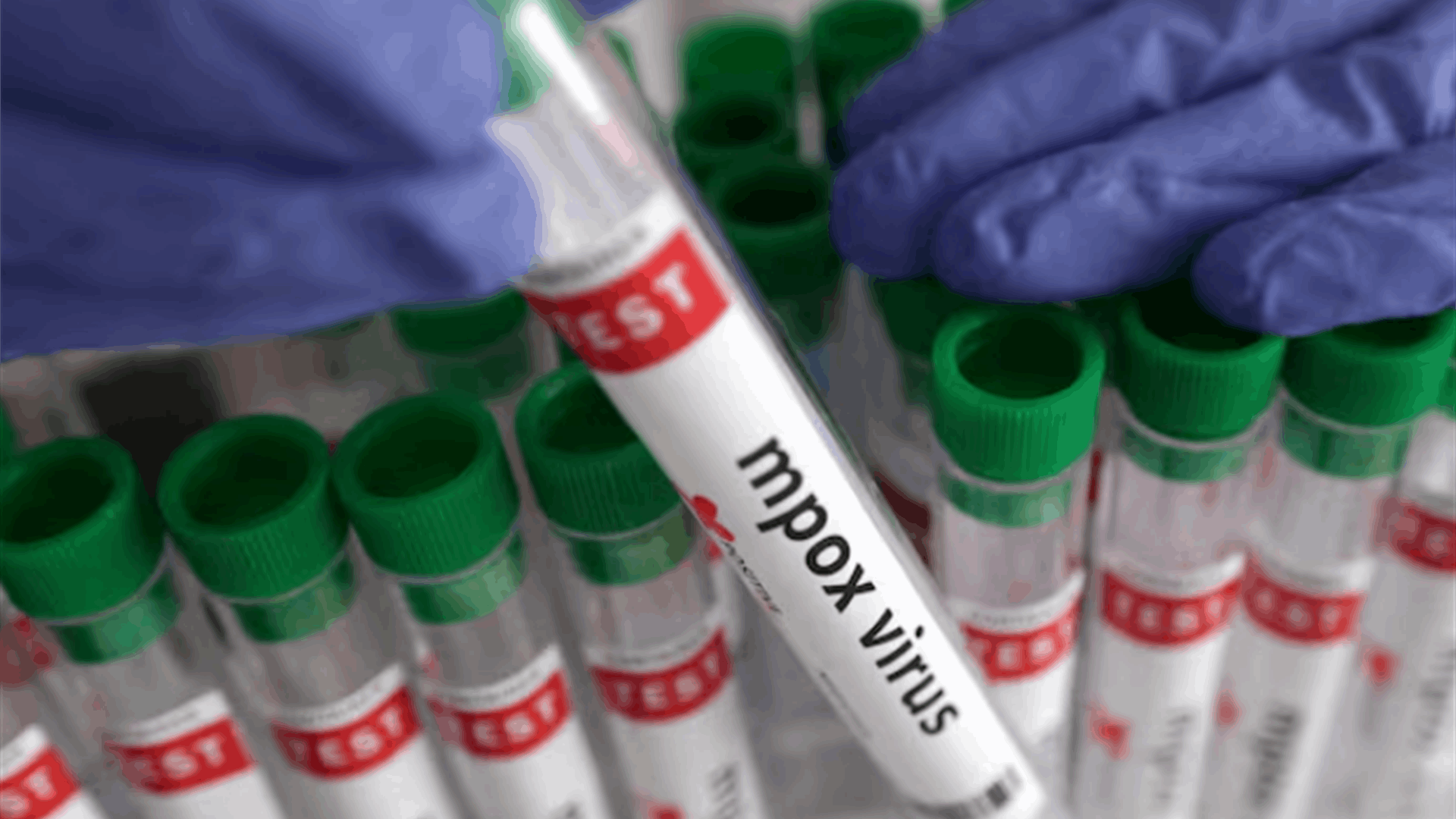 Germany to donate 100,000 mpox vaccine doses to combat outbreak in Africa