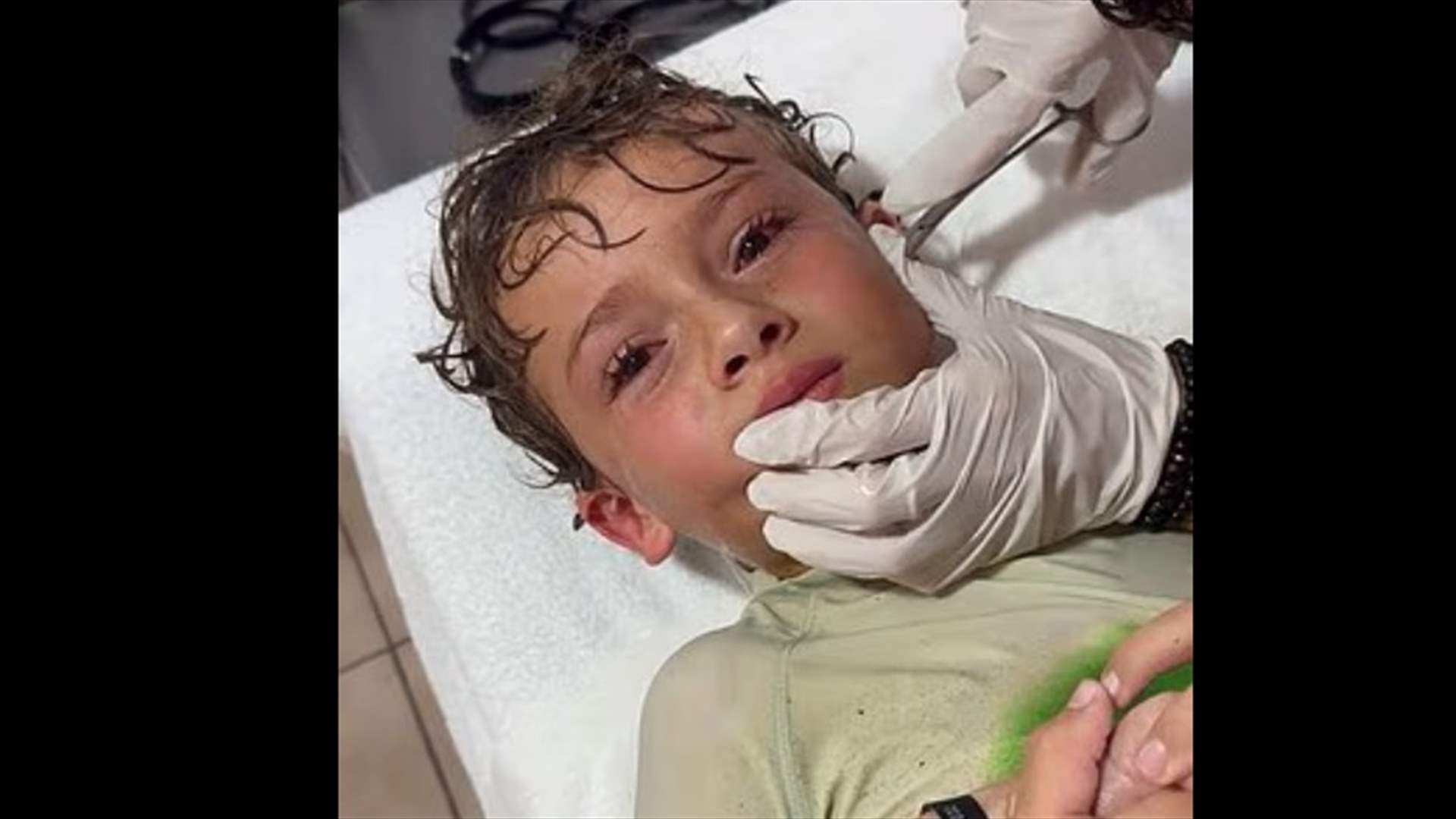 بعد زيارته الشاطئ شعر بشيء يتحرك داخل رأسه... ما استُخرج من أذن هذا الطفل صادم: إنه حيّ! (فيديو)