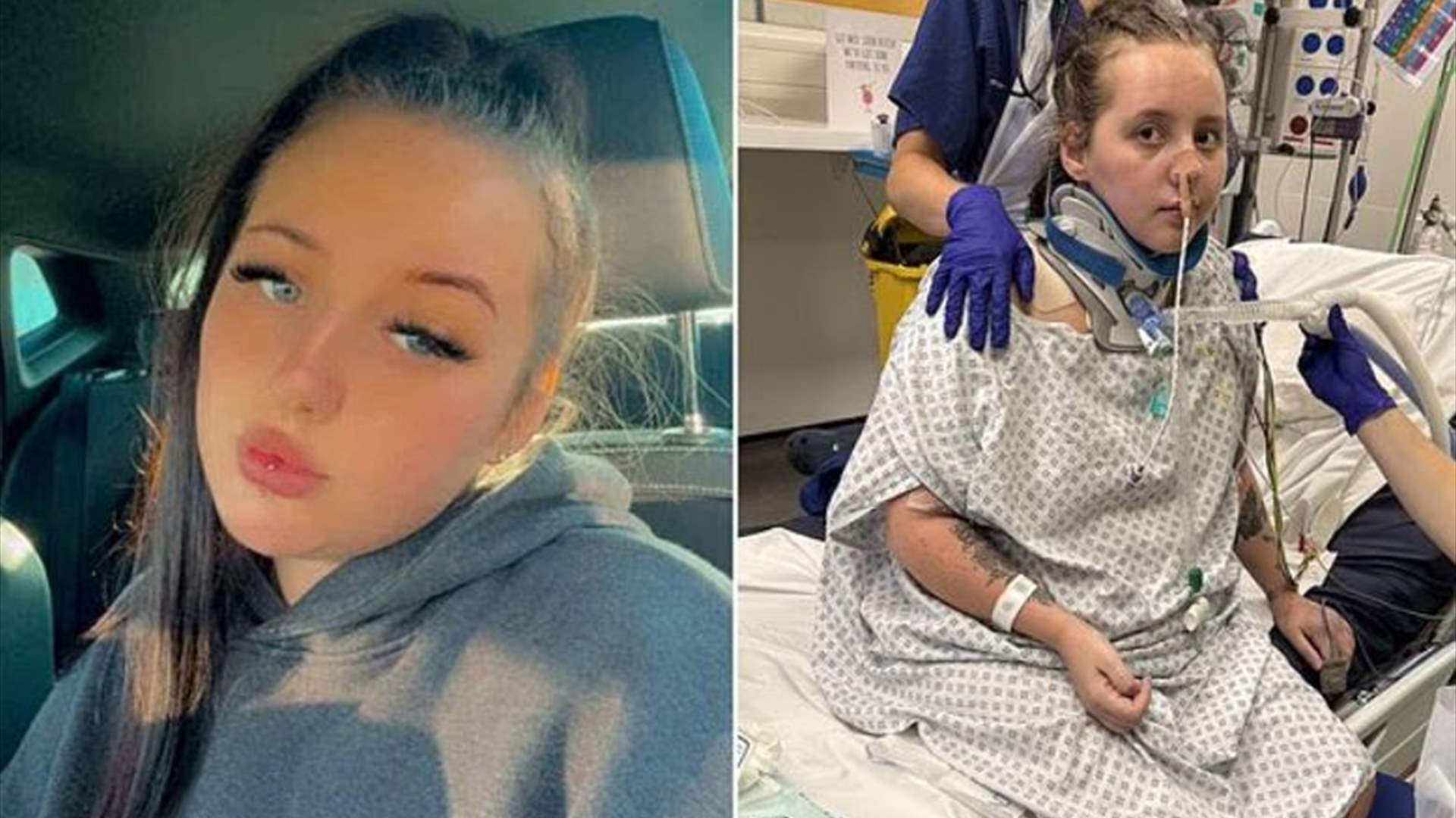 تعرضت لحادث مرعب ودخلت في غيبوبة... امرأة تروي قصتها المؤثرة :&quot;أعتقد أن هاتفي أنقذ حياتي&quot;