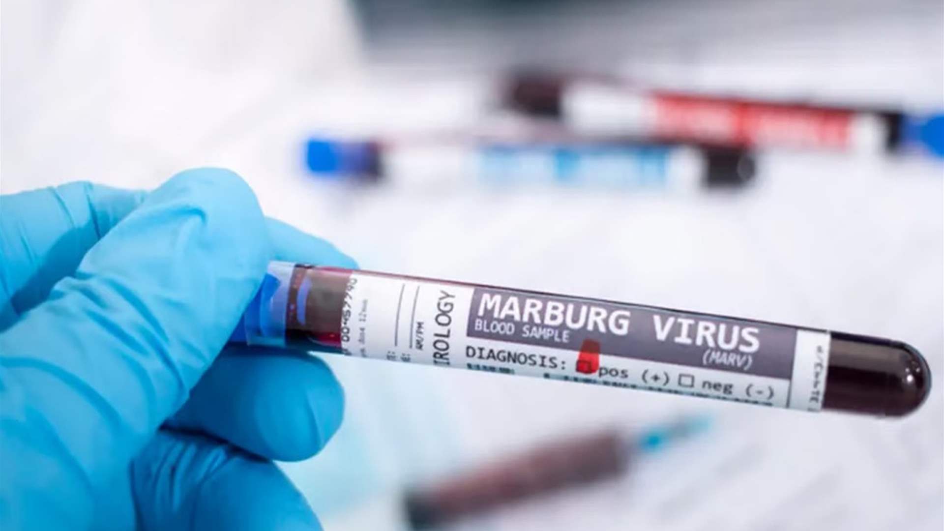 إثيوبيا: ارتفاع الوفيات جراء فيروس‭ ‬ماربورج إلى 6