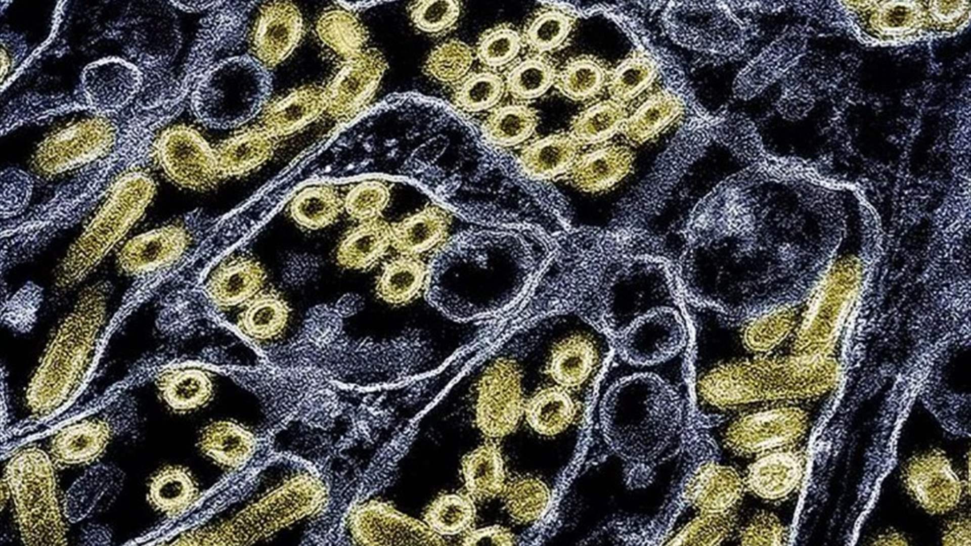 &quot;علينا أن نقلق&quot;... وفاة رجل بفيروس لا يصيب سوى الحيوانات وخبير يُحذّر: &quot;قد يتحوّل إلى جائحة جديدة&quot;