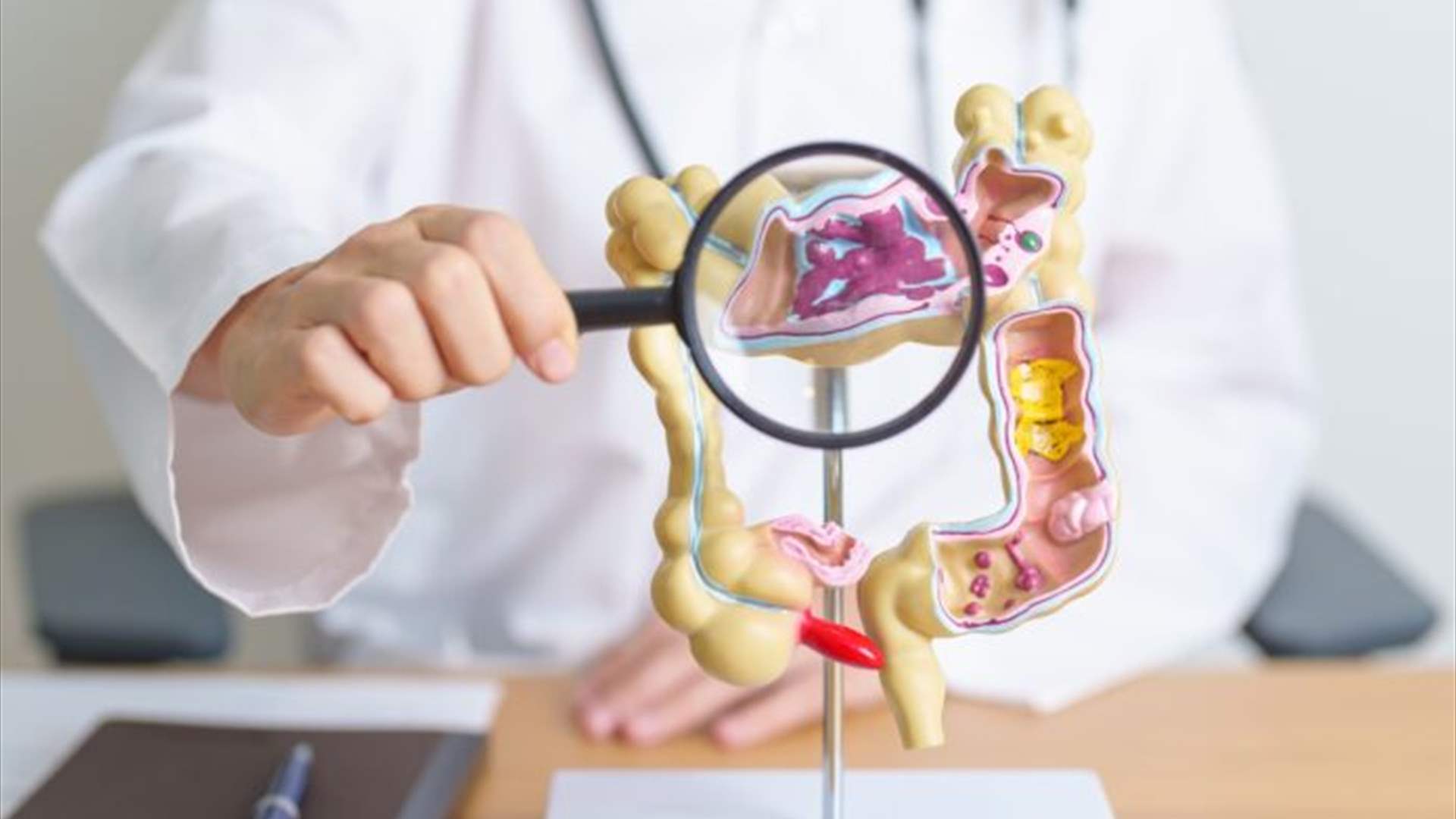 اكتشاف جيني جديد قد يساعد على منع نمو سرطان الأمعاء والكبد... إليكم هذه الدراسة!