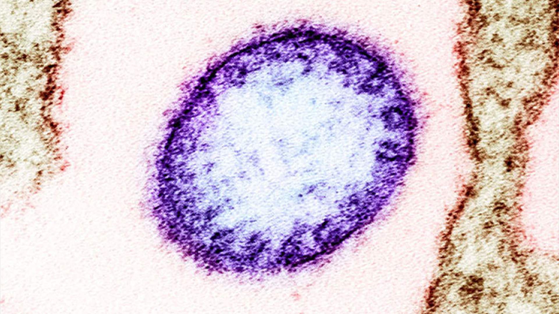 فيروس مخيف يقتل حتى 75% من المصابين… إليكم كل ما يجب معرفته عن فيروس نيباه 