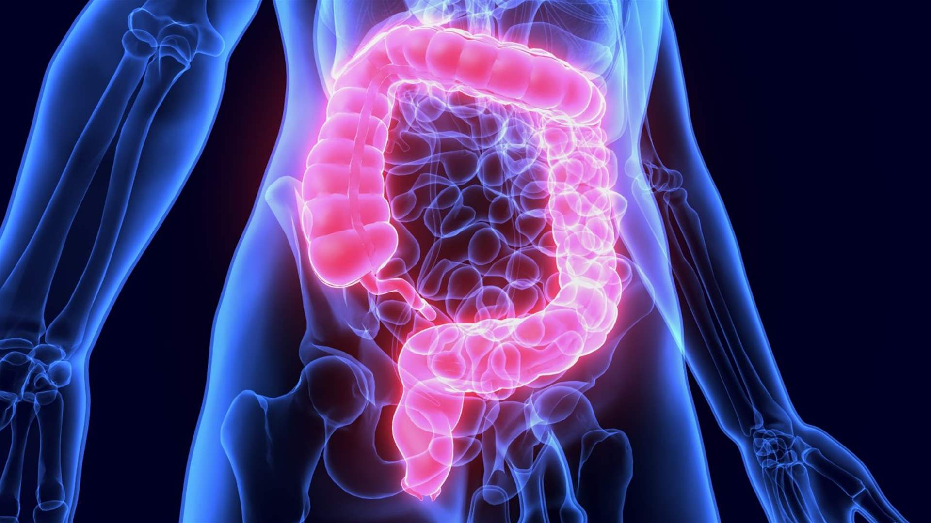 دراسة صادمة: مواليد التسعينات أكثر عرضة بأربع مرات للإصابة بسرطان القولون... وتحذيرات من منحى مقلق وغامض