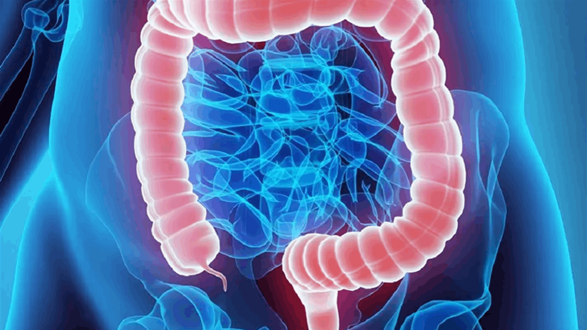 سرطان الأمعاء يهدد الشباب… خبراء يكشفون العادات اليومية التي ترفع خطر الإصابة قبل سن الخمسين