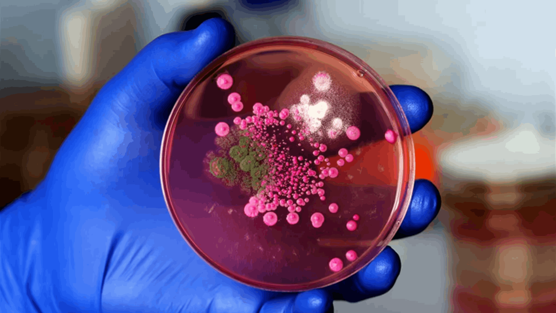 الثمن الصحي للحروب: "البكتيريا الخارقة" المقاومة للأدوية تنتشر خارج حدود النزاعات وأزمة صحية عالمية تلوح في الأفق