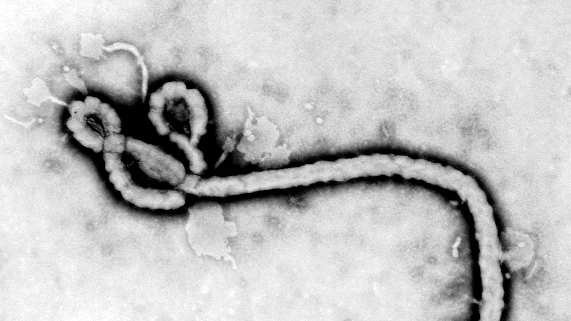 Ebola outbreak declared in eastern DR Congo: Health agency