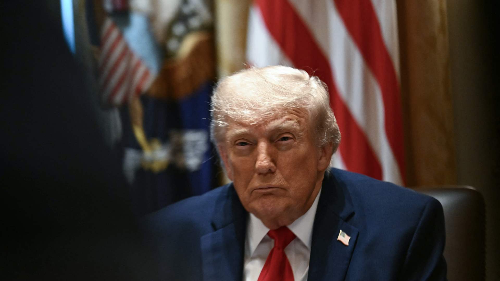 Trump in excellent health with leg swelling, hand bruising, doctor says