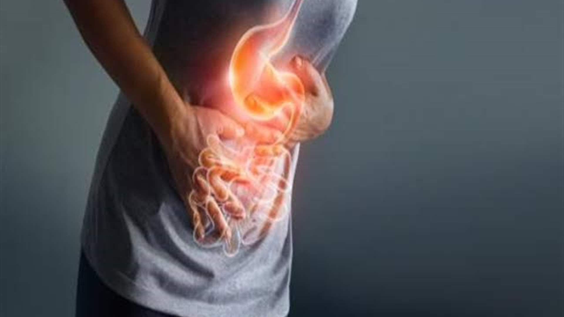 حرقة المعدة: كيف يمكن التخلص منها؟