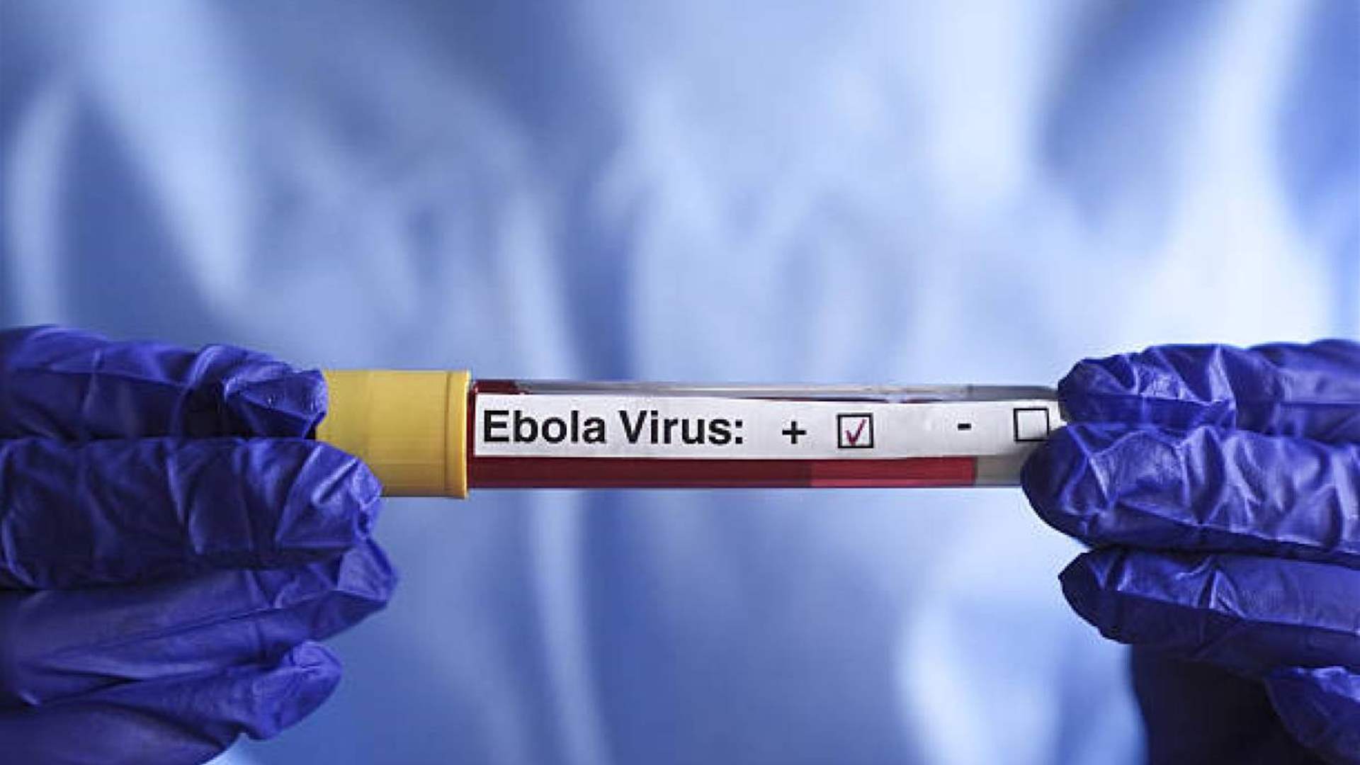 إصابات إيبولا في جمهورية الكونغو الديمقراطية تتجاوز 5 آلاف حالة