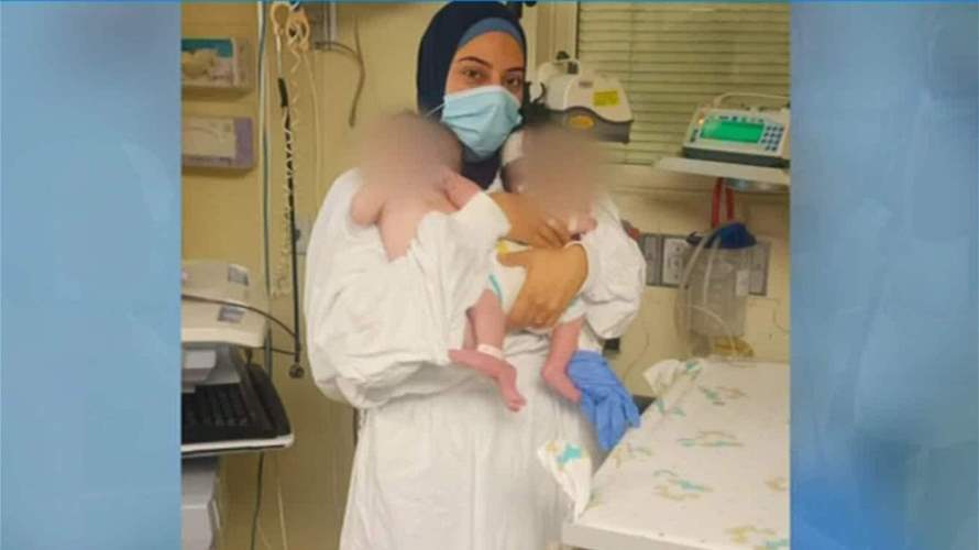 For the first time in Lebanon, separating Siamese twins ends successfully