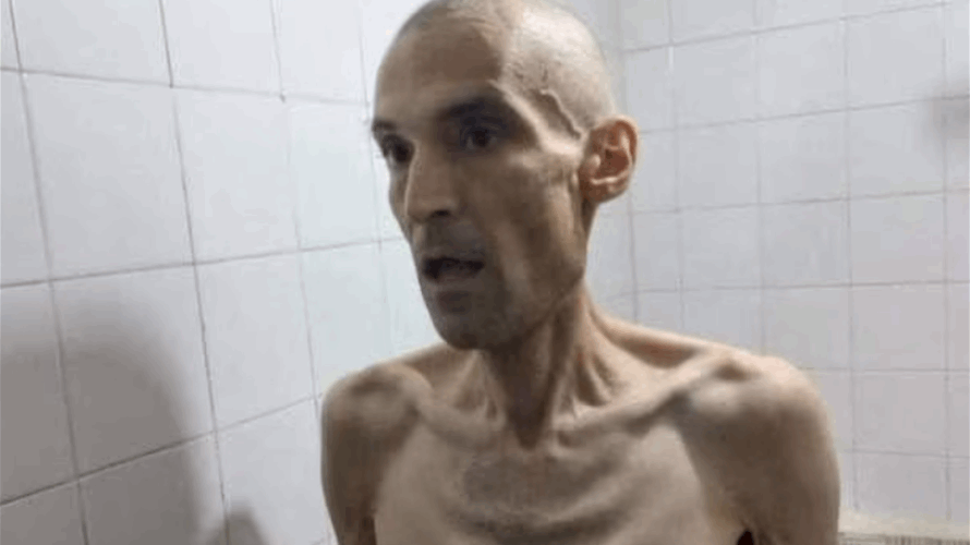 Images of emaciated Iranian prisoner on hunger strike prompt outrage