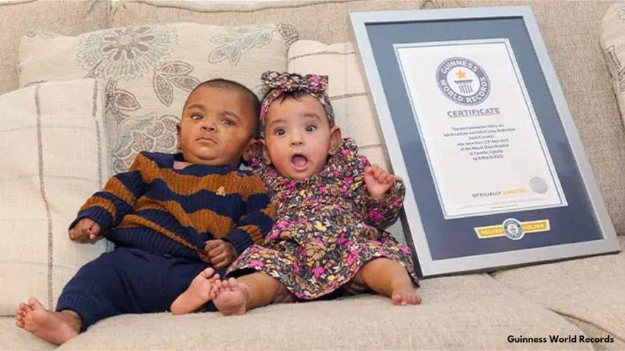توأم شهد أبكر ولادة في العالم يحتفل بعيد ميلاده الأول